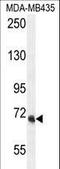 VPS52 Subunit Of GARP Complex antibody, LS-C160542, Lifespan Biosciences, Western Blot image 