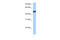 Hepatocyte Nuclear Factor 4 Gamma antibody, 30-082, ProSci, Enzyme Linked Immunosorbent Assay image 