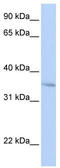 Four And A Half LIM Domains 3 antibody, TA339681, Origene, Western Blot image 