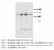 Angiopoietin 1 antibody, LS-C172155, Lifespan Biosciences, Western Blot image 