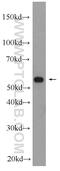 Major Facilitator Superfamily Domain Containing 8 antibody, 24298-1-AP, Proteintech Group, Western Blot image 