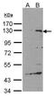 Signal-Induced Proliferation-Associated 1 antibody, GTX104786, GeneTex, Western Blot image 