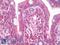 HIF-2-alpha antibody, LS-C227496, Lifespan Biosciences, Immunohistochemistry paraffin image 