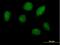 Homeobox A1 antibody, H00003198-B01P, Novus Biologicals, Immunocytochemistry image 