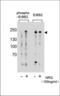 ERBB2 antibody, TA324786, Origene, Western Blot image 