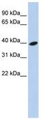 ADP Ribosylation Factor Like GTPase 13B antibody, ab83879, Abcam, Western Blot image 