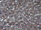 Thioredoxin Domain Containing 5 antibody, M05772-1, Boster Biological Technology, Immunohistochemistry paraffin image 