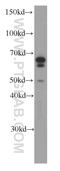 Melanophilin antibody, 66092-1-Ig, Proteintech Group, Western Blot image 