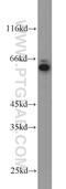 Dopamine Beta-Hydroxylase antibody, 10777-1-AP, Proteintech Group, Western Blot image 