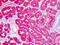 Carnosine Dipeptidase 2 antibody, LS-B8974, Lifespan Biosciences, Immunohistochemistry paraffin image 