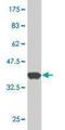 Starch Binding Domain 1 antibody, H00008987-M11, Novus Biologicals, Western Blot image 