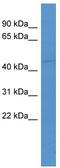 Ligand Dependent Nuclear Receptor Corepressor antibody, TA342758, Origene, Western Blot image 