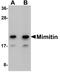 NADH:Ubiquinone Oxidoreductase Complex Assembly Factor 2 antibody, A08718, Boster Biological Technology, Western Blot image 