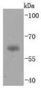 Immunoglobulin Heavy Constant Alpha 1 antibody, A07514-1, Boster Biological Technology, Western Blot image 