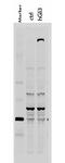 GLI Family Zinc Finger 3 antibody, A01171, Boster Biological Technology, Western Blot image 