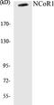 Nuclear Receptor Corepressor 1 antibody, EKC1395, Boster Biological Technology, Western Blot image 