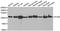 Glycogen Phosphorylase B antibody, abx004896, Abbexa, Western Blot image 