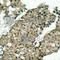 G3BP Stress Granule Assembly Factor 1 antibody, AP0352, ABclonal Technology, Immunohistochemistry paraffin image 