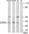 Cyclin Dependent Kinase 2 antibody, LS-C118835, Lifespan Biosciences, Western Blot image 