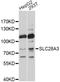 Solute Carrier Family 28 Member 3 antibody, A10320, ABclonal Technology, Western Blot image 