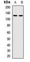 Kinesin Family Member C3 antibody, LS-C668712, Lifespan Biosciences, Western Blot image 