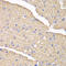 Voltage Dependent Anion Channel 1 antibody, LS-C748679, Lifespan Biosciences, Immunohistochemistry paraffin image 