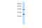 Proteasome 26S Subunit, Non-ATPase 4 antibody, 27-557, ProSci, Enzyme Linked Immunosorbent Assay image 