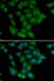 Calcium/Calmodulin Dependent Protein Kinase I antibody, LS-C346186, Lifespan Biosciences, Immunofluorescence image 