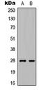 Complement C1q Like 3 antibody, LS-B13653, Lifespan Biosciences, Western Blot image 