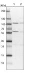 Alcohol Dehydrogenase Iron Containing 1 antibody, NBP1-83530, Novus Biologicals, Western Blot image 