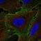 Interleukin 12 Receptor Subunit Beta 1 antibody, NBP2-57287, Novus Biologicals, Immunofluorescence image 