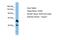 Thrombospondin Type 1 Domain Containing 1 antibody, PA5-43330, Invitrogen Antibodies, Western Blot image 