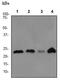 Parkinsonism Associated Deglycase antibody, ab76008, Abcam, Western Blot image 