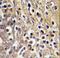 Cytochrome P450 Family 19 Subfamily A Member 1 antibody, LS-C100198, Lifespan Biosciences, Immunohistochemistry paraffin image 