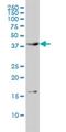 Calcium/calmodulin-dependent protein kinase type 1 antibody, H00008536-M01, Novus Biologicals, Western Blot image 