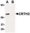 Prostaglandin D2 Receptor 2 antibody, PA5-20332, Invitrogen Antibodies, Western Blot image 