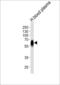 Serpin Family A Member 6 antibody, LS-B10686, Lifespan Biosciences, Western Blot image 