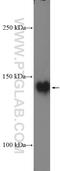 Protein Tyrosine Kinase 7 (Inactive) antibody, 17799-1-AP, Proteintech Group, Western Blot image 
