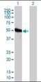 Phosphoribosylglycinamide Formyltransferase, Phosphoribosylglycinamide Synthetase, Phosphoribosylaminoimidazole Synthetase antibody, orb89588, Biorbyt, Western Blot image 