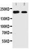 TSC Complex Subunit 2 antibody, PA2175, Boster Biological Technology, Western Blot image 