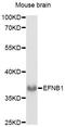 Ephrin B1 antibody, LS-C749561, Lifespan Biosciences, Western Blot image 