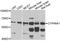 Cholesterol 24-hydroxylase antibody, A03772, Boster Biological Technology, Western Blot image 