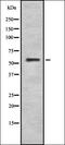 Cytochrome P450 Family 4 Subfamily F Member 2 antibody, orb378268, Biorbyt, Western Blot image 