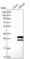 Leucine Rich Repeat Containing 29 antibody, NBP1-83919, Novus Biologicals, Western Blot image 