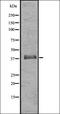 Olfactory Receptor Family 52 Subfamily R Member 1 (Gene/Pseudogene) antibody, orb336476, Biorbyt, Western Blot image 