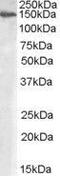 Mannosidase Alpha Class 2A Member 1 antibody, GTX88874, GeneTex, Western Blot image 