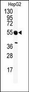 Serine/Threonine Kinase 25 antibody, AP14843PU-N, Origene, Western Blot image 