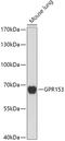 G Protein-Coupled Receptor 153 antibody, 18-150, ProSci, Western Blot image 