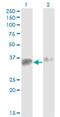 Survival Of Motor Neuron 2, Centromeric antibody, H00006607-M02, Novus Biologicals, Western Blot image 