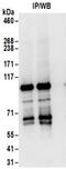 ArfGAP With GTPase Domain, Ankyrin Repeat And PH Domain 2 antibody, NBP2-32176, Novus Biologicals, Immunoprecipitation image 
